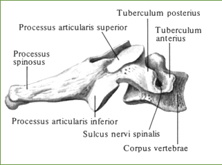 Шестой шейный позвонок, выступающий, 